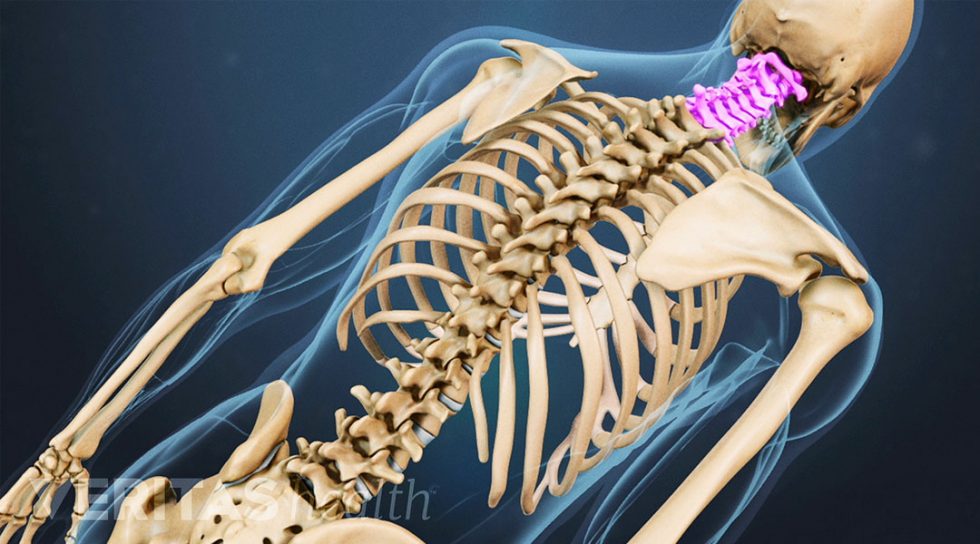 Spinal Instrumentation Dr. Vimar Dakour